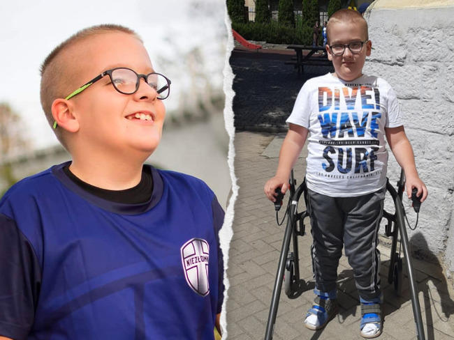 Trwa batalia o sprawność Alanka! Pilnie potrzebne środki na kolejny zabieg [FOTO] 