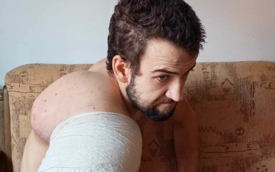 Trwa mobilizacja sił dla Stasia. Strzegomianin rozpoczął kolejny bój z nowotworem  