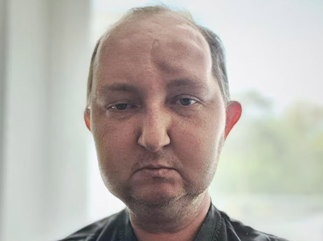 Strzegomianin od niemal 5 lat walczy z nowotworem. Potrzebne jest wsparcie dla Norberta! 