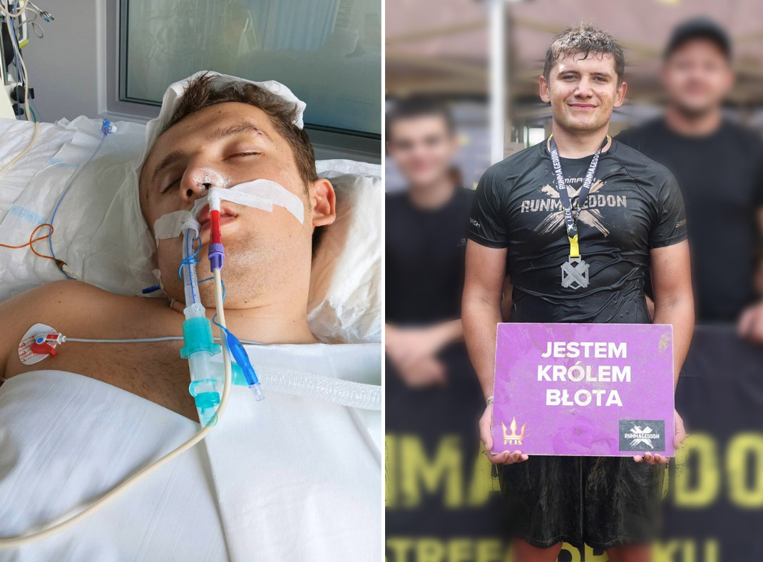 21-latek ze Strzegomia walczy o życie po urazie głowy. Trwa zbiórka na jego rehabilitację 